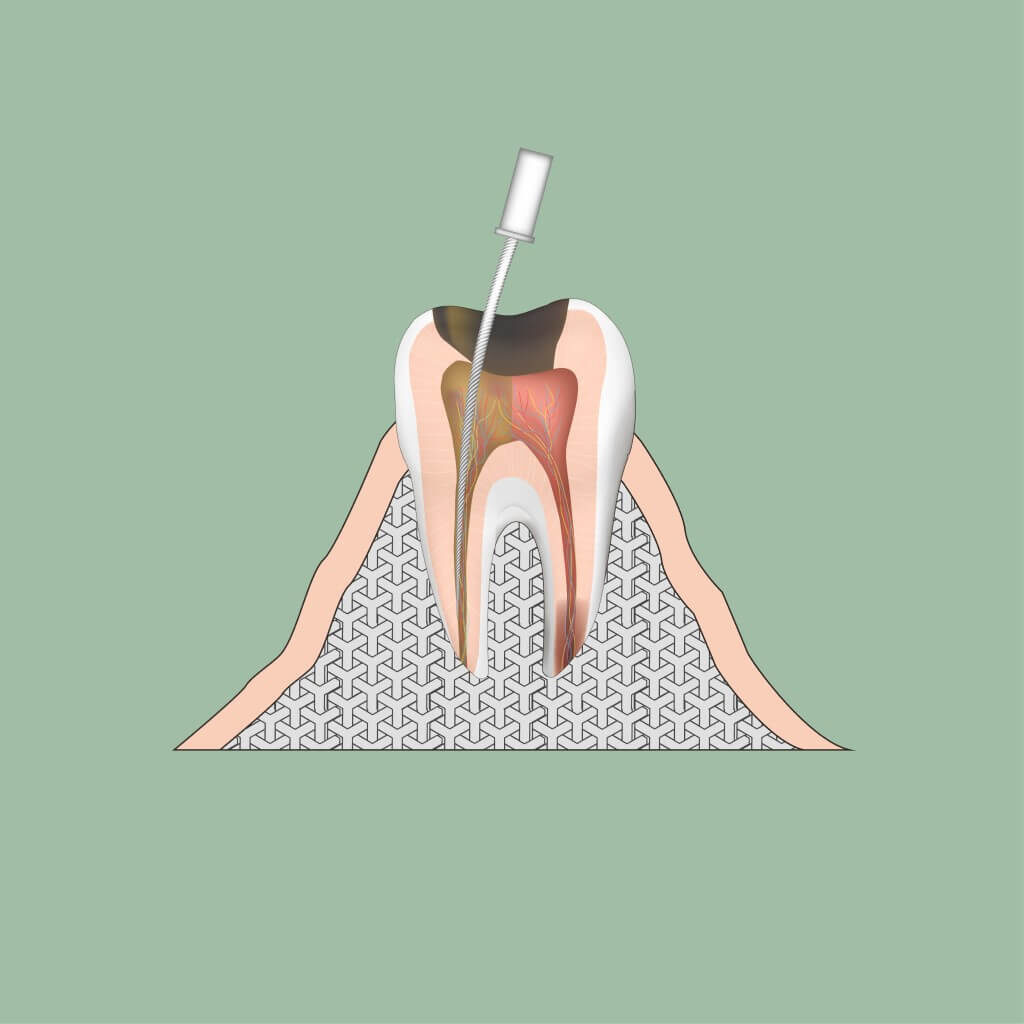 Endodontologie